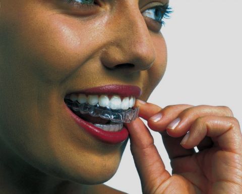 Beautiful woman applying teeth whitening strips